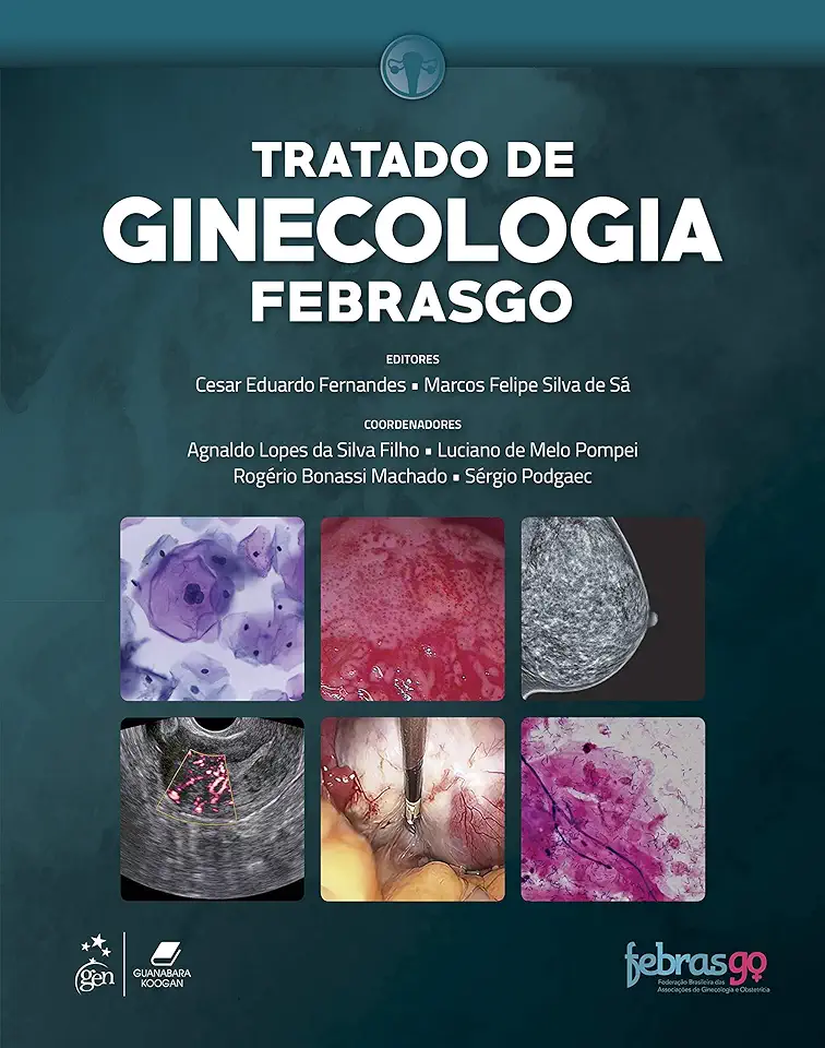Treatise on Gynecology - Febrasgo