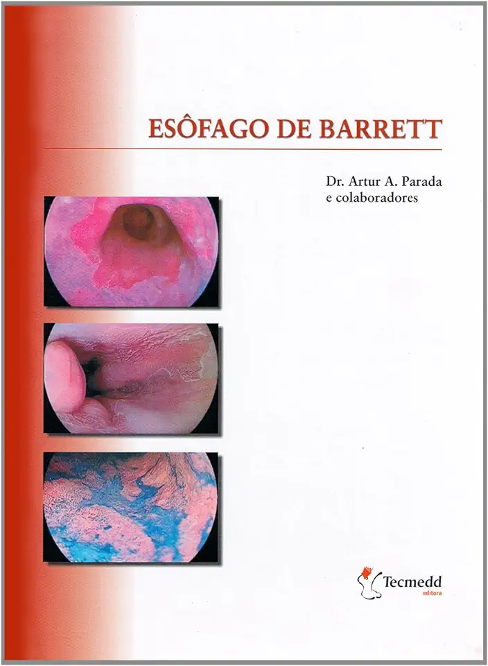 Capa do Livro Esofago de Barrett  - Artur A. Parada