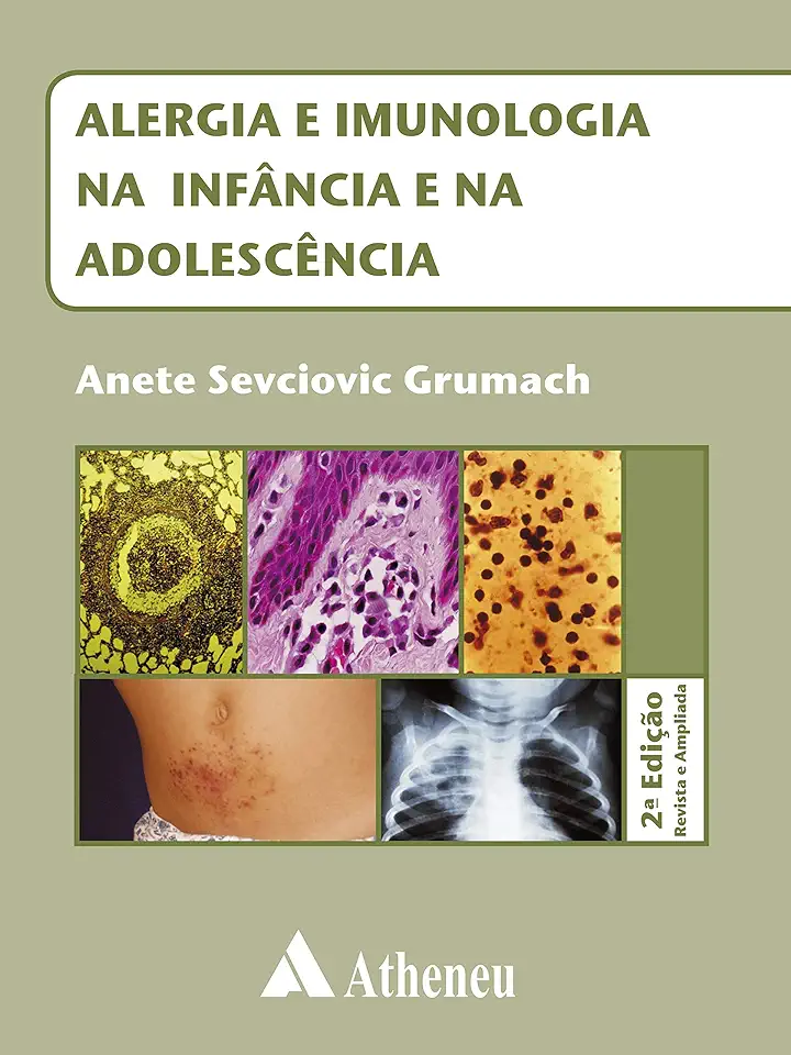 Capa do Livro Alergia e Imunologia na Infância e na Adolescência - Anete Sevciovic Grumach