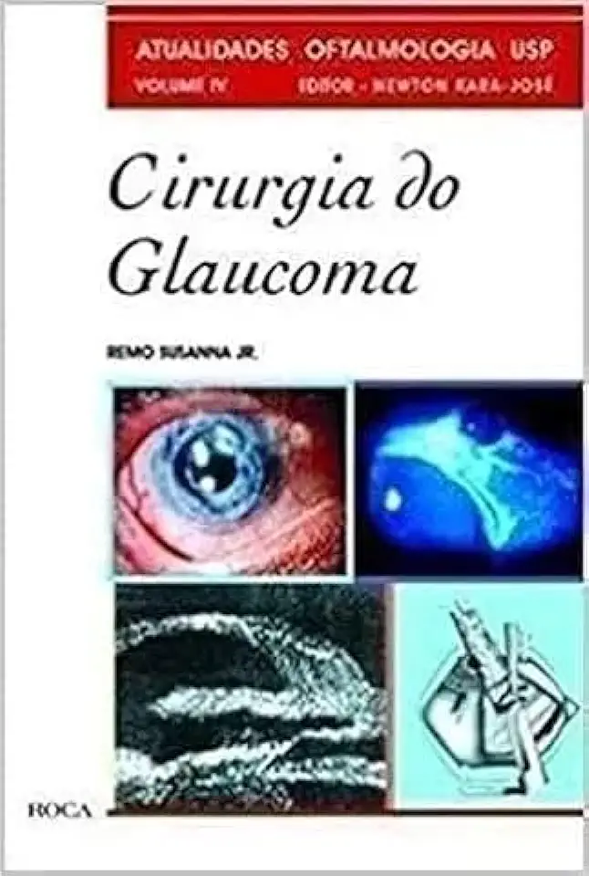 Capa do Livro Cirurgia do Glaucoma - Remo Susanna Jr.