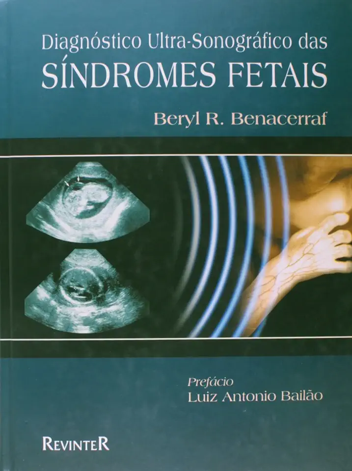 Ultrasound Diagnosis of Fetal Syndromes - Beryl R. Benacerraf