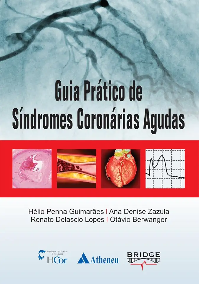 Capa do Livro Guia Prático de Síndrome Coronária Aguda - Helio Penna Guimarães